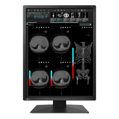 Б/У Монитор 21" Eizo RadiForce RX270 / 1200x1600 UXGA / WLED / IPS / 20 мс / DVI, DisplayPort, USB Hub, Type-C (не предназначен для передачи данных или видеосигнала) / Класс А /